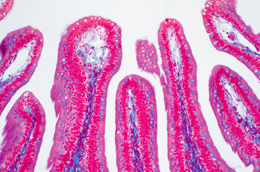 badania na celiakie - zanik kosmkow jelitowych